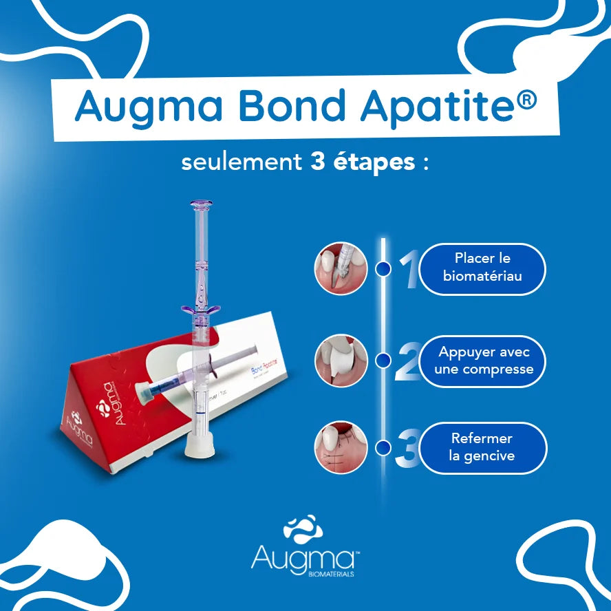 Bond Apatite™ 1 seringa - preenchimento ósseo instantâneo | Augma Biomaterials™