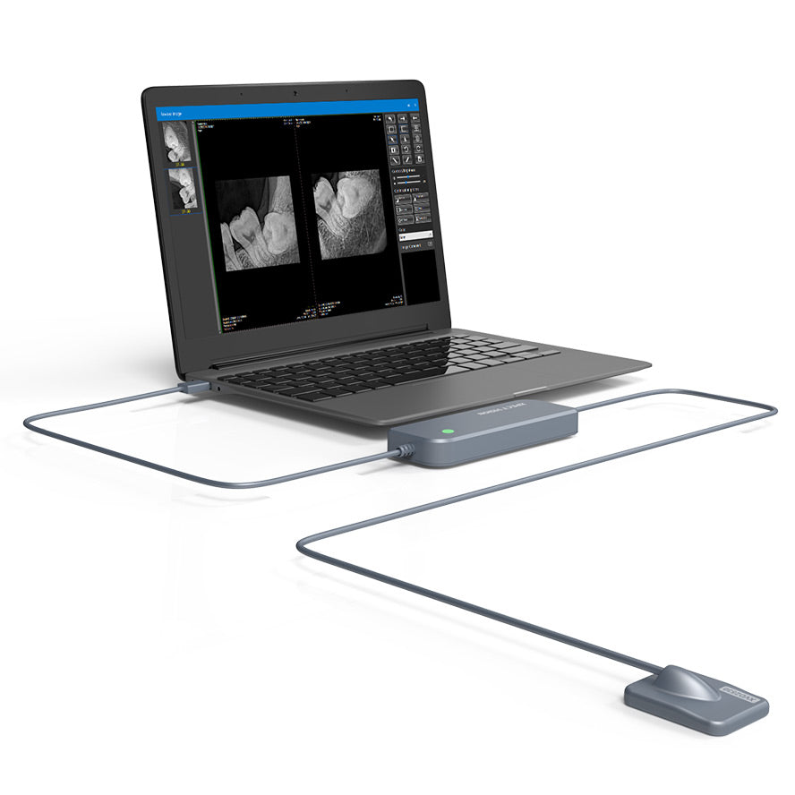 Capteur intra-oral X-ray sensor - XPECT VISION - ootopfti.com