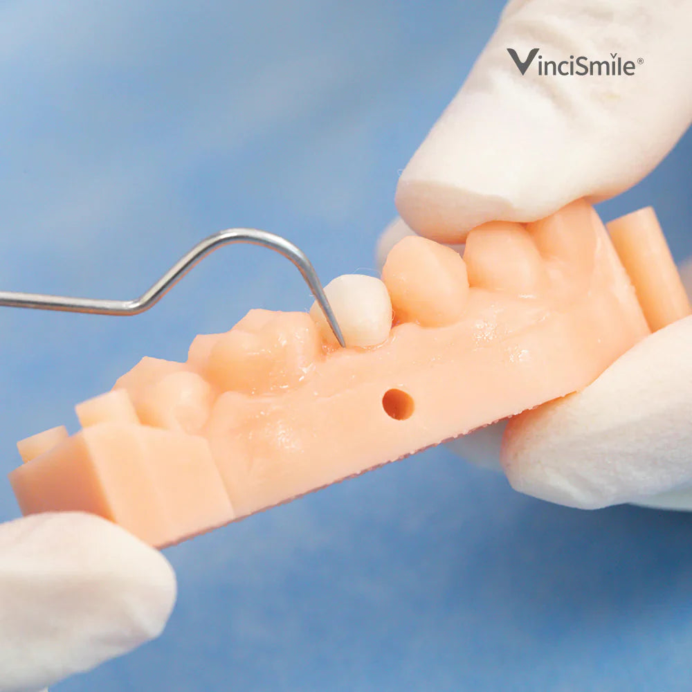 Cemento de resina de curado dual TopCEM x1 jeringa - VINCISMILE