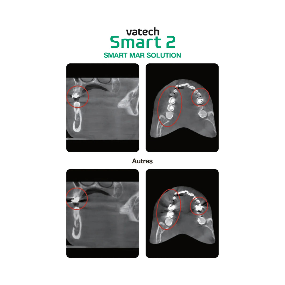 Système d’imagerie CT & panoramique 3D / 2D - Smart 2 - Vatech - ootopfti.com