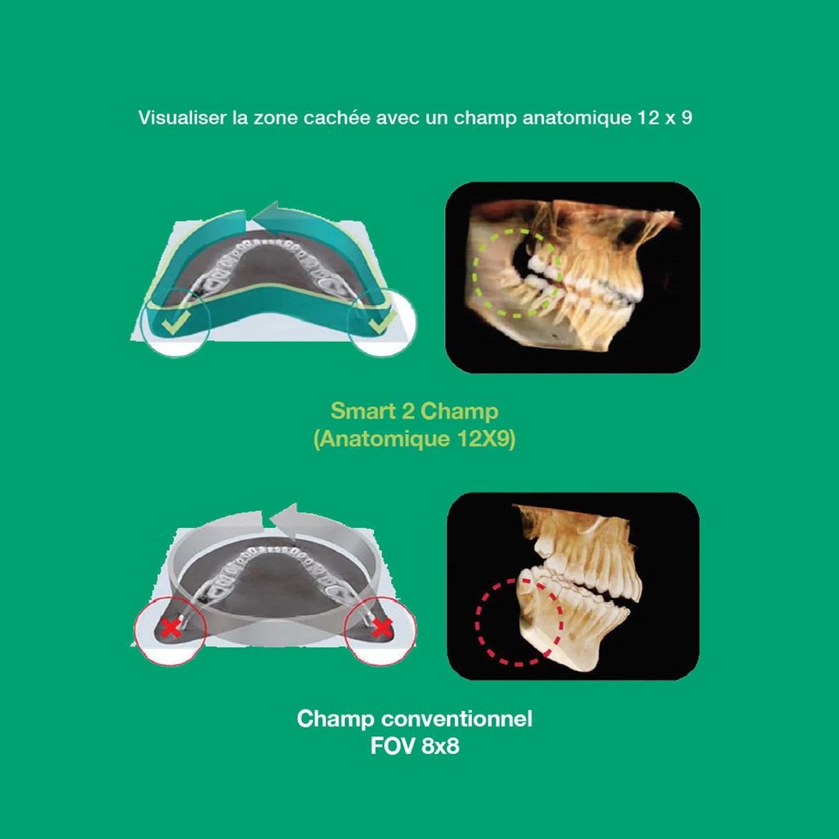 Système d’imagerie CT & panoramique 3D / 2D - Smart 2 - Vatech - ootopfti.com