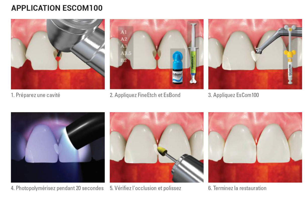 1 seringue de4g EsCom100 - B2 - Résine composite nano-hybride restauratrice photopolymérisable - ootopfti.com
