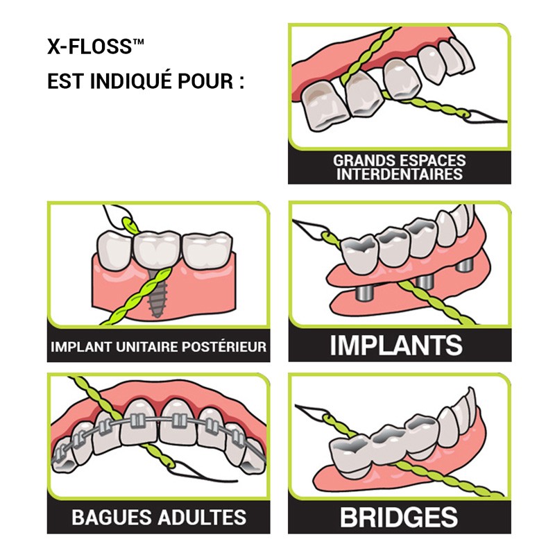X-Floss - ootopfti.com