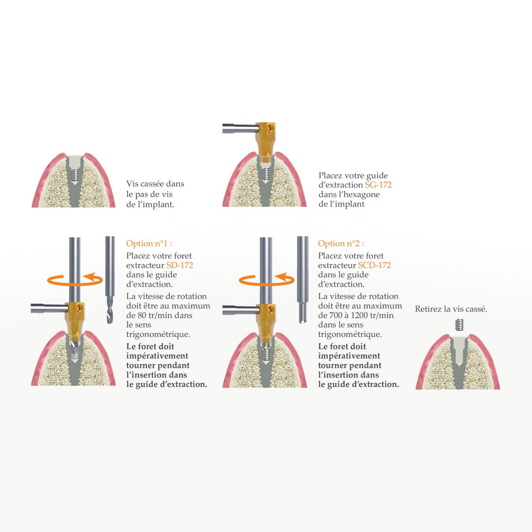 SOS Kit - Extraction rapide & sécurisée de vis d’implant cassées par Safe Implant - ootopfti.com