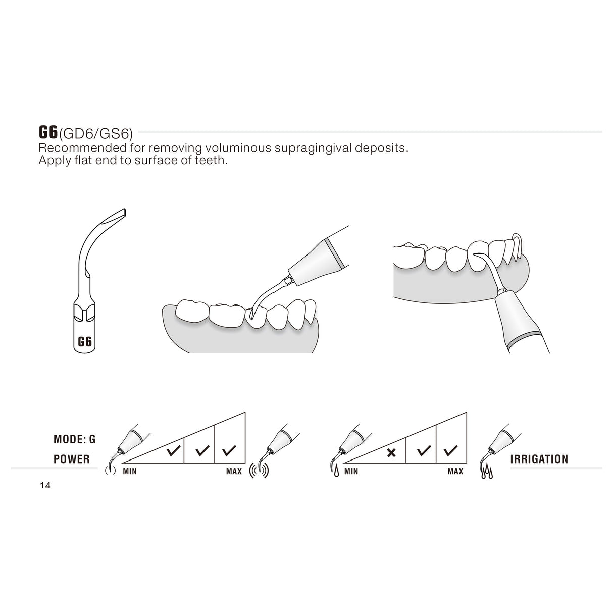Insert G6 compatible EMS ultrarésistant UR - WOODPECKER - ootopfti.com