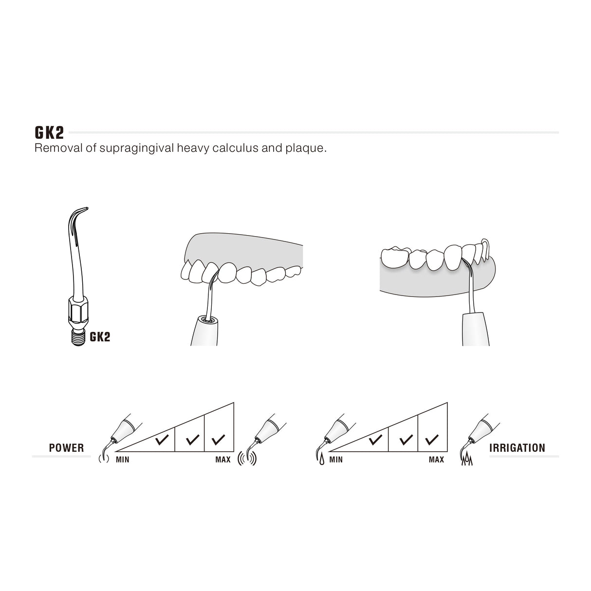 KAVO UltraResistant UR compatible GK2 insert
