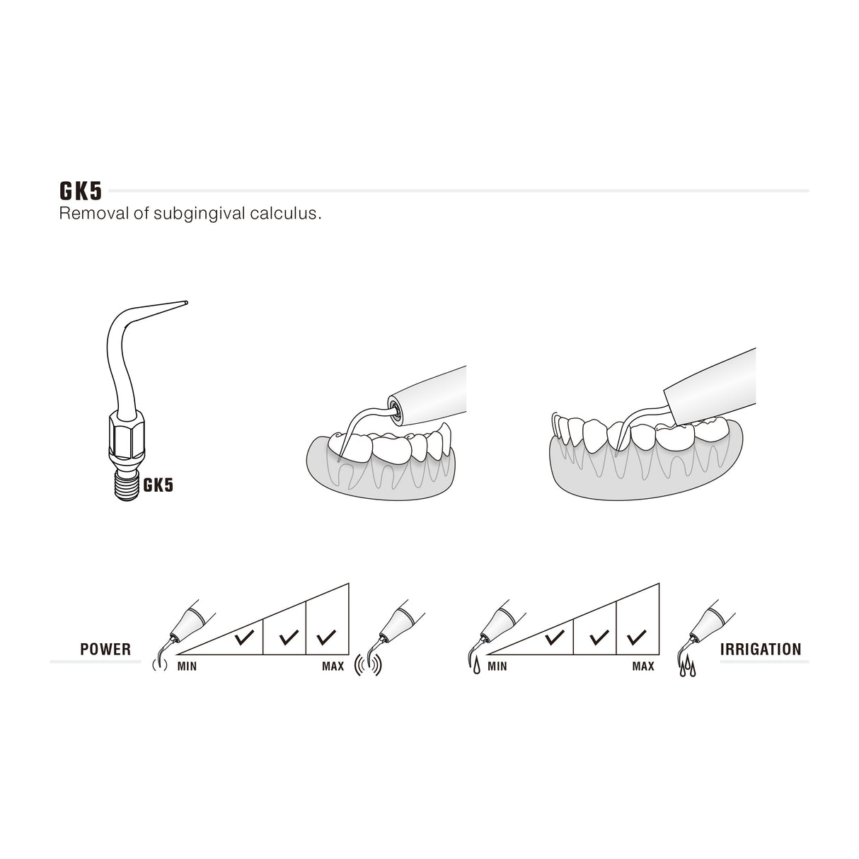 Insert GK5 compatible KAVO UltraResistant UR - ootopfti.com