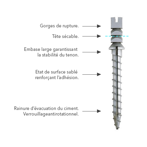 Poste de tornillo de titanio Europosts - Anthogyr