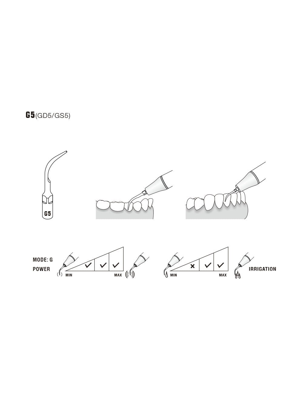 Insert G5 compatible EMS ultrarésistant UR - WOODPECKER - ootopfti.com