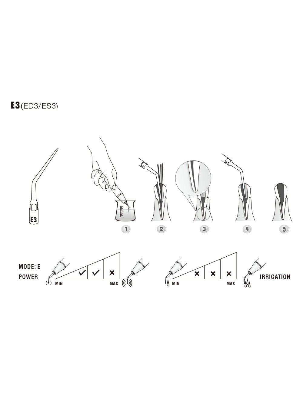 Insert E3 compatible EMS ultrarésistant UR - WOODPECKER - ootopfti.com