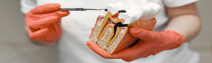 Accessoires endodontie
