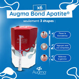 boite 6x Bond Apatite™ comblement osseux instantané par Augma Biomaterials™ - ootopfti.com