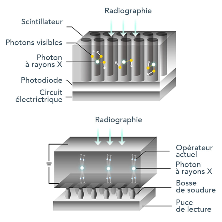 Capteur intra-oral X-ray sensor - XPECT VISION - ootopfti.com