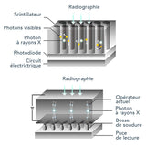 Capteur intra-oral X-ray sensor - XPECT VISION - ootopfti.com