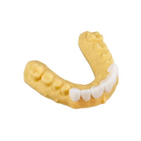 Résine 3D gingivale pour impression en 3D 1kg - GINGIVA - ArmaResin - ootopfti.com