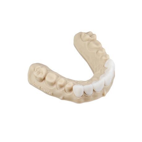 Résine 3D longue durée pour bridges implantaires provisoires 1kg - TEMP ULTRA - ArmaResin - ootopfti.com