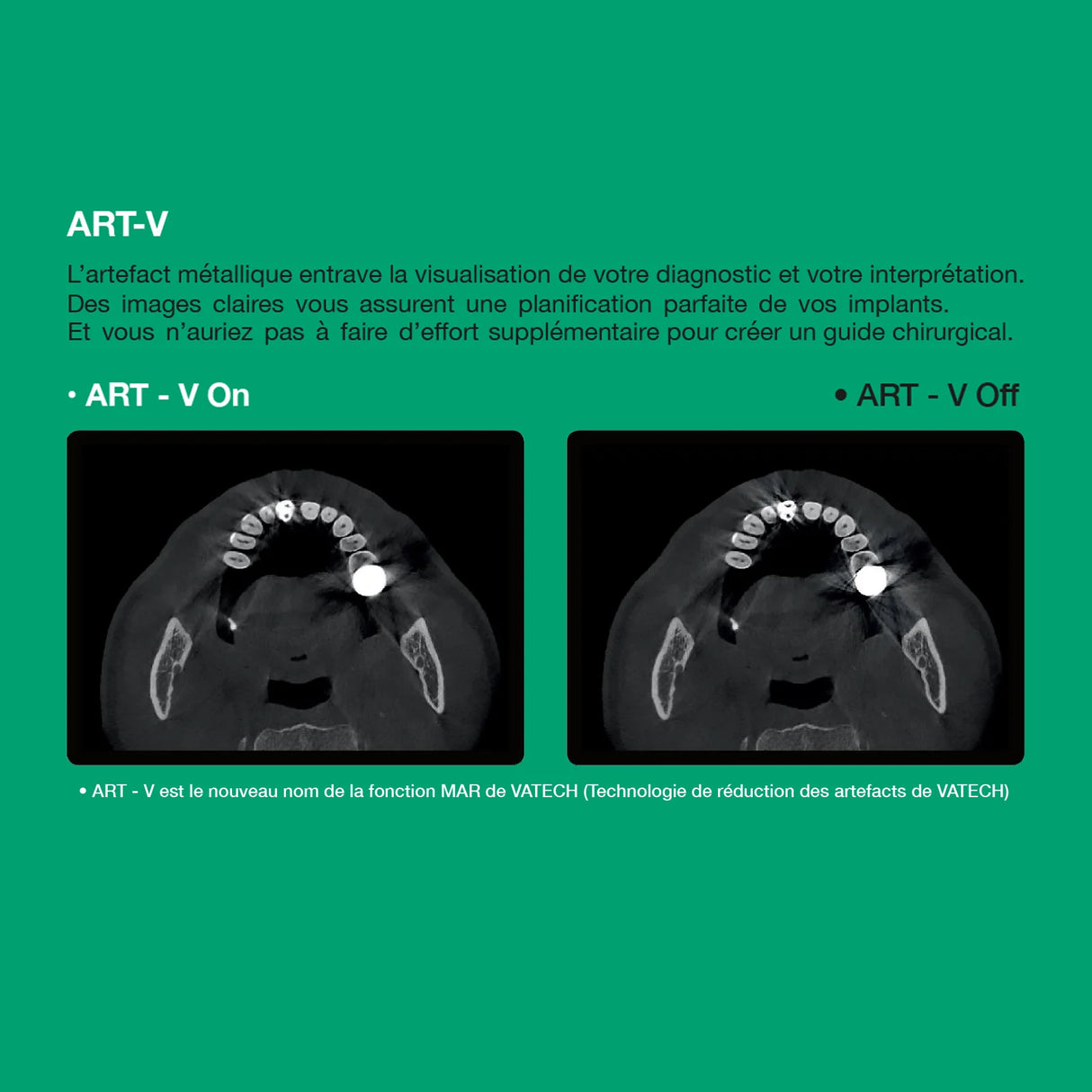 Système d’imagerie 4-en-1 3D / 2D - Green 2 - Vatech - ootopfti.com