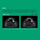 Système d’imagerie 4-en-1 3D / 2D - Green 2 - Vatech - ootopfti.com