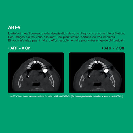 Système d’imagerie 4-en-1 3D / 2D - Green 2 - Vatech - ootopfti.com
