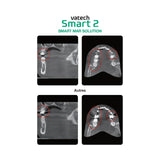 Système d’imagerie CT & panoramique 3D / 2D - Smart 2 - Vatech - ootopfti.com
