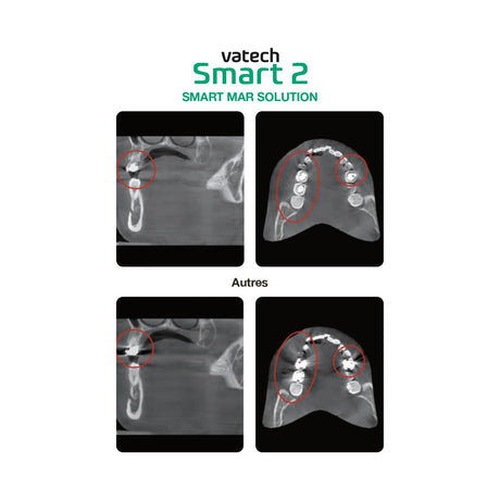 Système d’imagerie CT & panoramique 3D / 2D - Smart 2 - Vatech - ootopfti.com