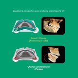Système d’imagerie CT & panoramique 3D / 2D - Smart 2 - Vatech - ootopfti.com