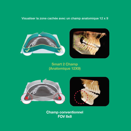 Système d’imagerie CT & panoramique 3D / 2D - Smart 2 - Vatech - ootopfti.com