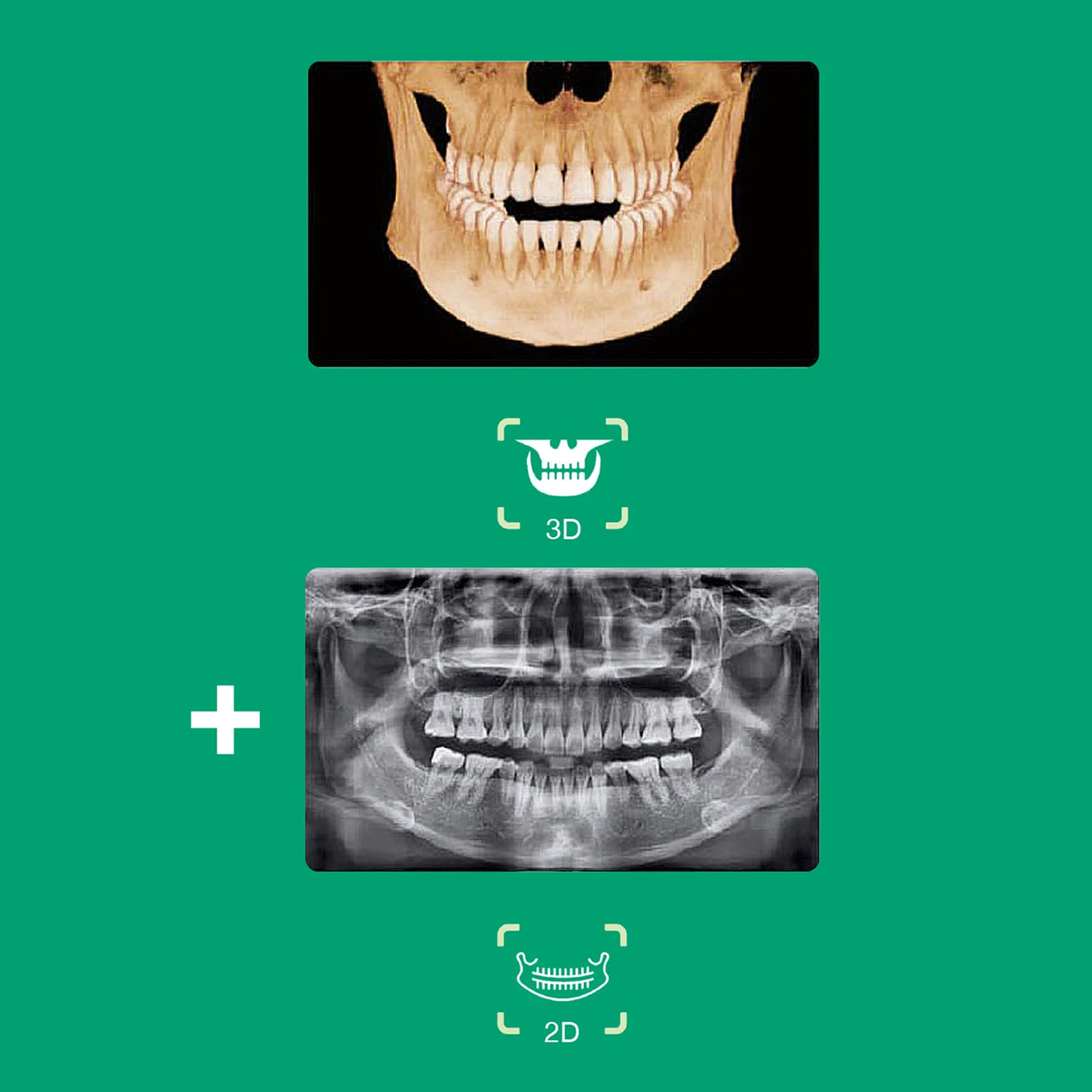Système d’imagerie CT & panoramique 3D / 2D - Smart 2 - Vatech - ootopfti.com
