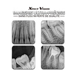 Capteur intra-oral X-ray sensor | Xpect Vision - ootopfti.com