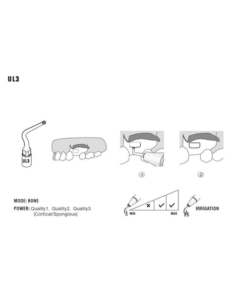 Insert UL3 pour chirurgie piezo - WOODPECKER - ootopfti.com