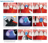 Kit Core.it Résine fluide à double polymérisation pour faux moignon - ootopfti.com