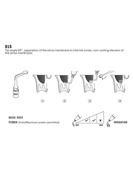 Insert UL5 pour chirurgie piezo - WOODPECKER - ootopfti.com