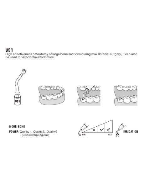 Insert US1 pour chirurgie piezo - WOODPECKER - ootopfti.com