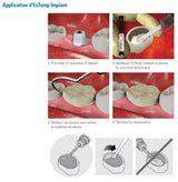 EsTemp Implant 1x 8g Ciment temporaire à base de résine sans eugénol pour les couronnes retenues par implants - ootopfti.com