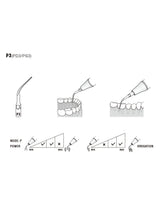 Insert PD3 compatible Satelec - WOODPECKER - ootopfti.com