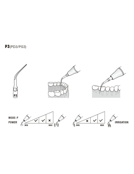 Insert P3 compatible EMS  ultrarésistant UR - WOODPECKER - ootopfti.com