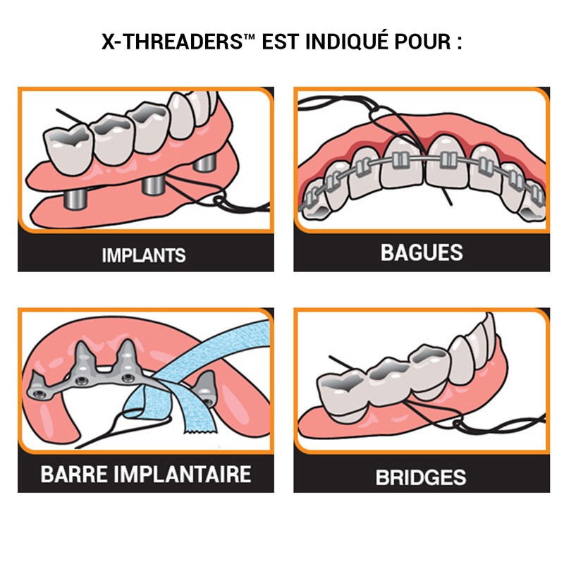 X-Threaders - ootopfti.com