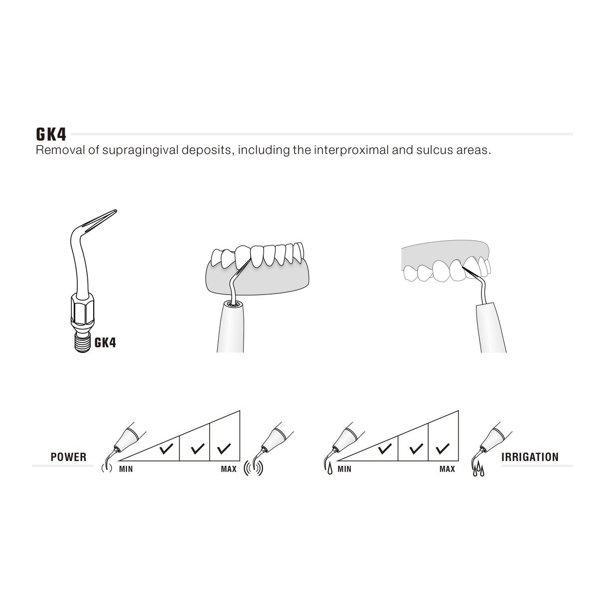 Insert GK4 compatible KAVO UltraResistant UR - ootopfti.com