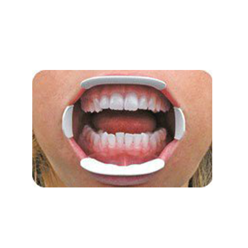 Optiview Ecarteur labial et jugal - Kerr - ootopfti.com