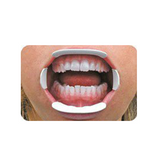 Optiview Ecarteur labial et jugal - Kerr - ootopfti.com