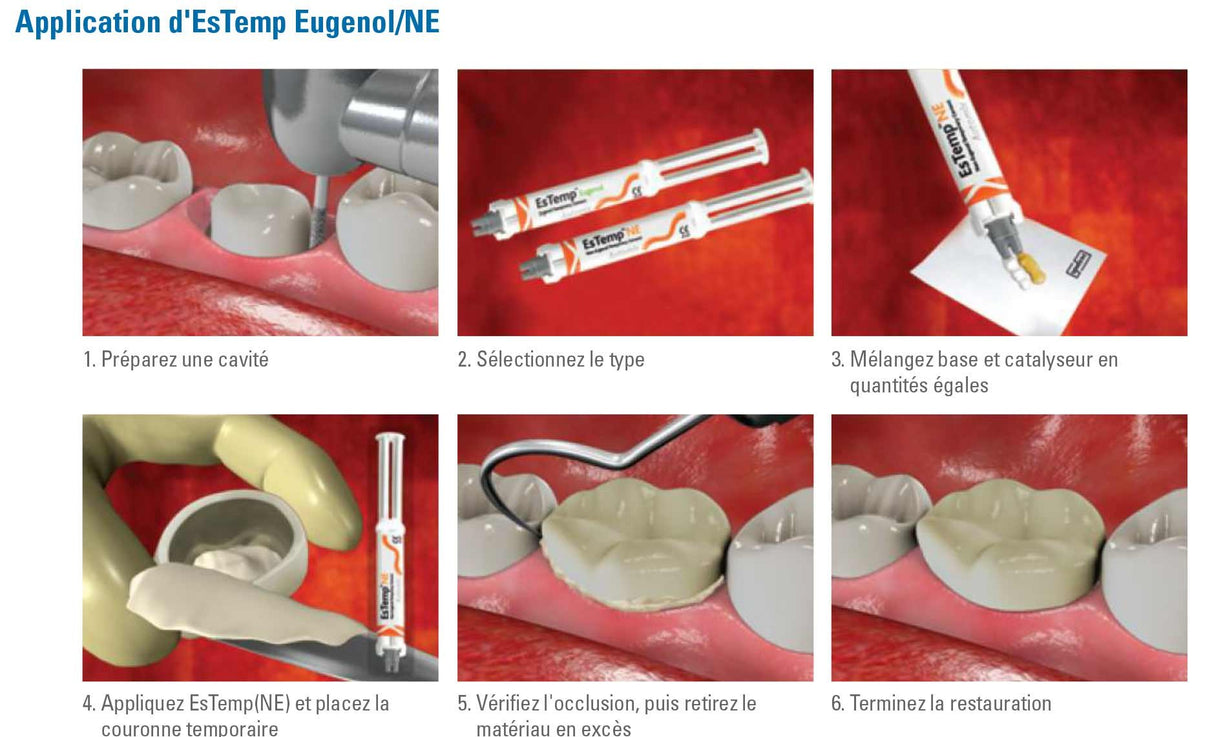 EsTemp Eugenol 2x 10g Ciment temporaire pour couronnes et bridges temporaires - ootopfti.com