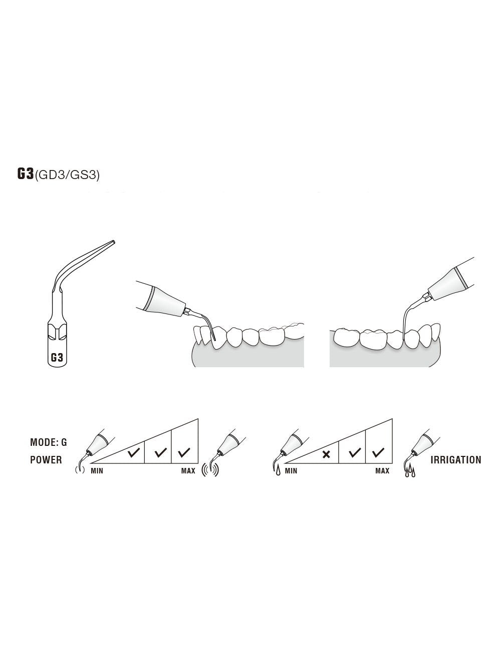 Insert G3 compatible EMS ultrarésistant UR - WOODPECKER - ootopfti.com