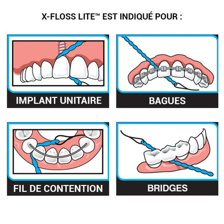 X-Floss lite - ootopfti.com