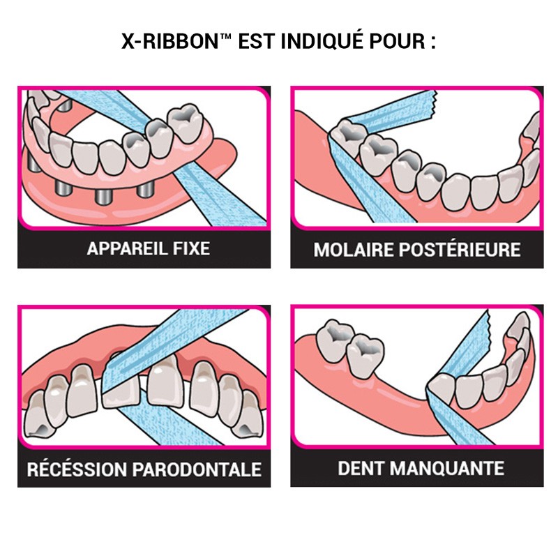 X-Ribbon - ootopfti.com