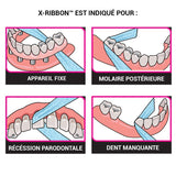 X-Ribbon - ootopfti.com