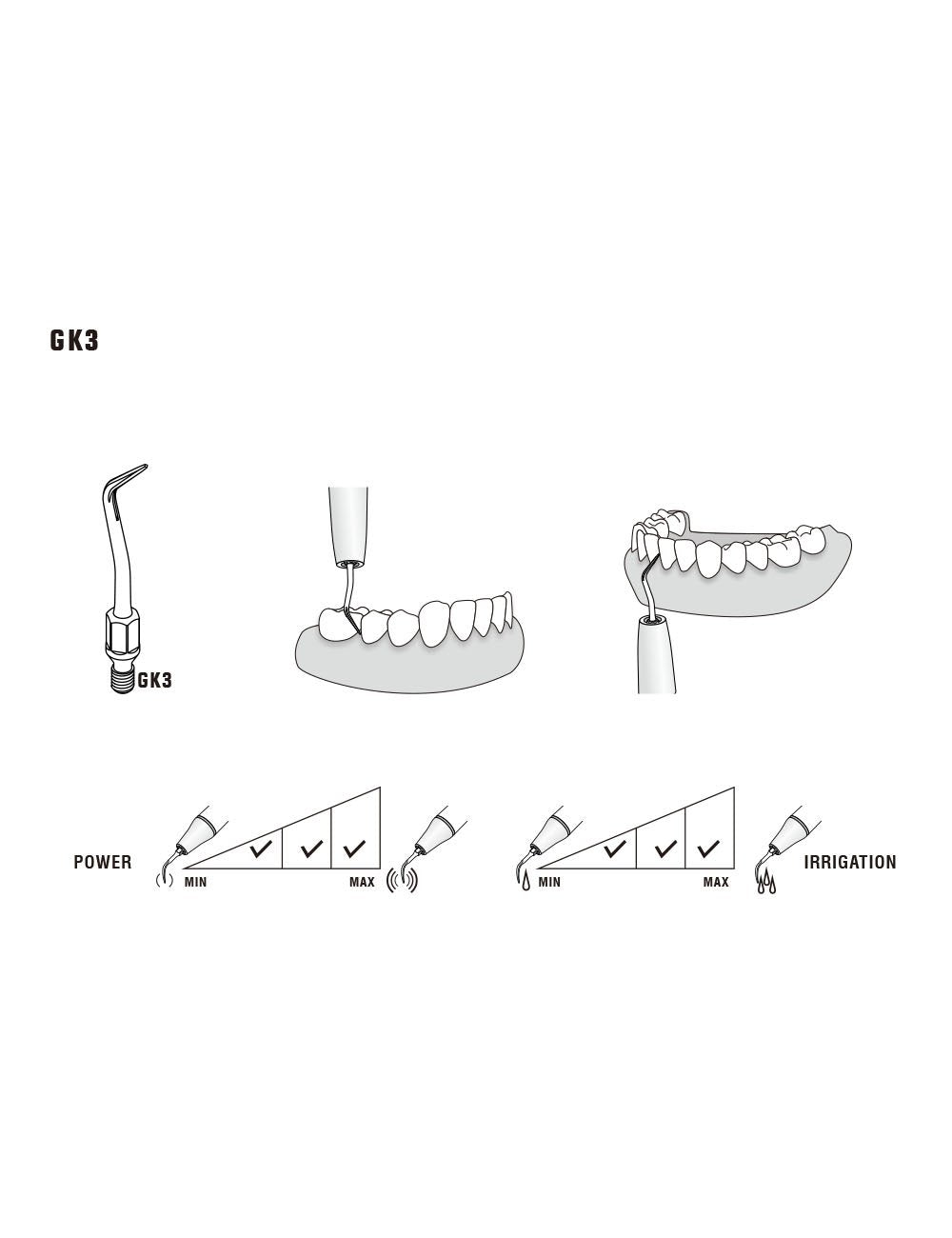 Insert GK3 compatible KAVO - WOODPECKER - ootopfti.com