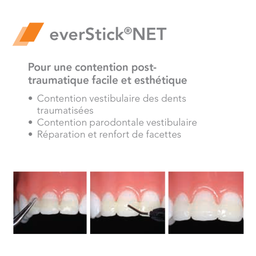 EverStick COMBI Fibra de vidrio - GC