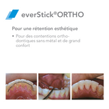 EverStick ORTHO Fibra de vidro - GC