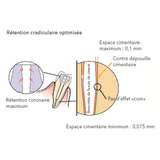 Fibio Tenons fibre de verre - Anthogyr