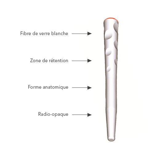 Fibio Tenons fibre de verre - Anthogyr